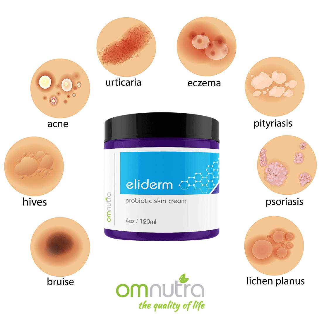OmNutra Topical Probiotic Skin Cream - 4OZ Jar 13 Strain Moisturizing Probiotic Lotion Eczema Treatment Psoriasis Treatment for