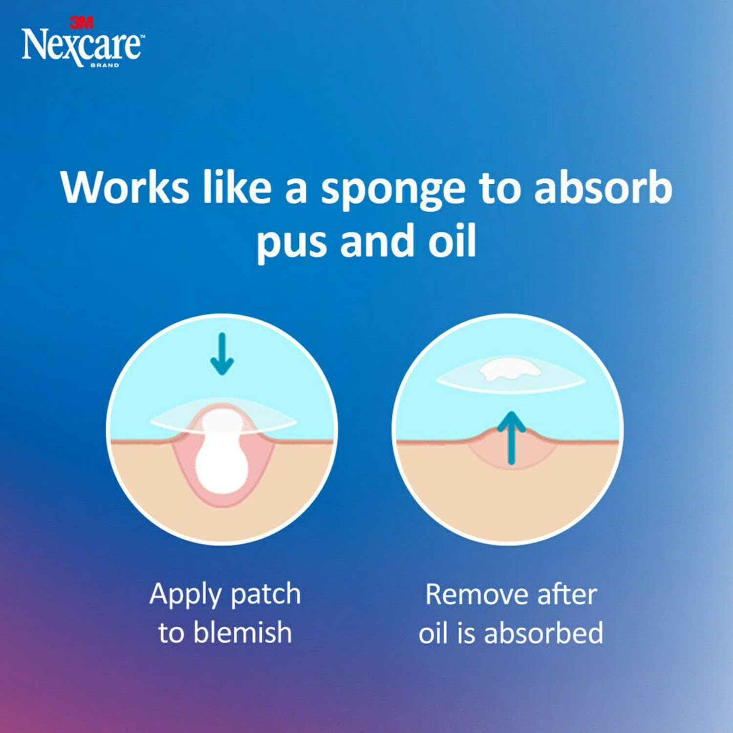 Nexcare Thin and Transparent Acne Patch, Skin Cover Absorbs Pus and Oil from Clogged Pores, made with hydrocolloid, tab allows f