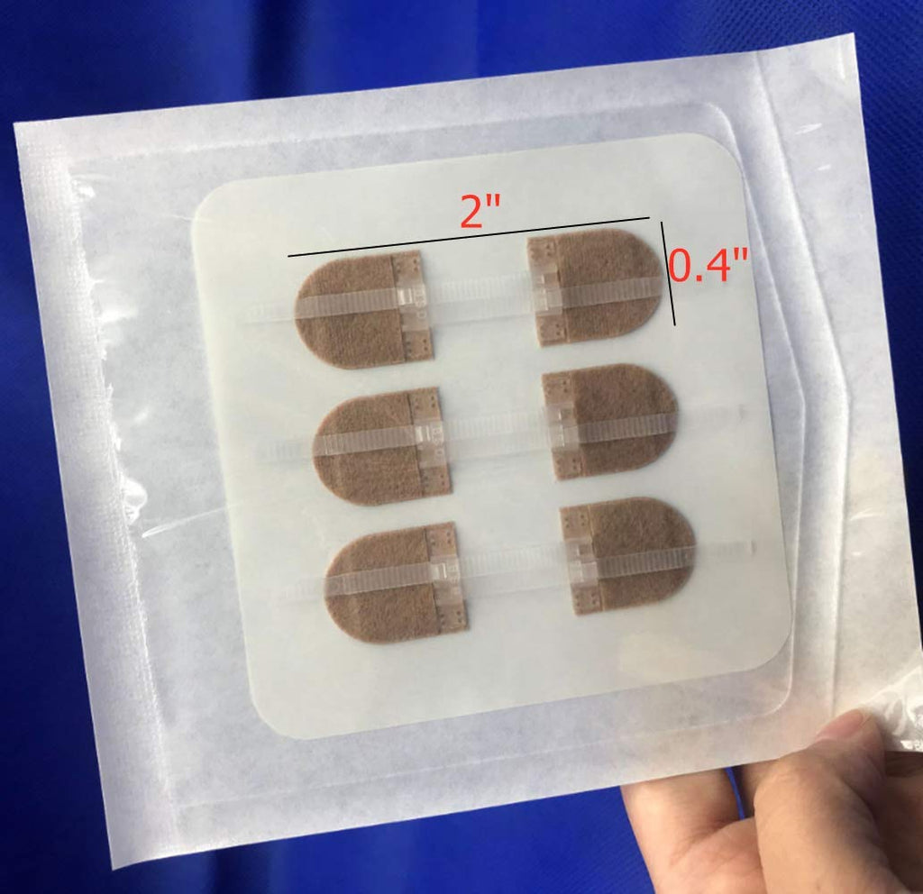 Emergency Wound Closures Adhesive Bandages, Zip Stitch Stickers for Camping, Survival & Household Gear, 3 Pcs (45 * 10mm, Skin)