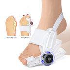 Yosoo Bunion Corrector Bunion Corrector Splint, Hallux Valgus Corrector Big Toe Brace Adjust Degrees Thicken Silicone Prevent Ov