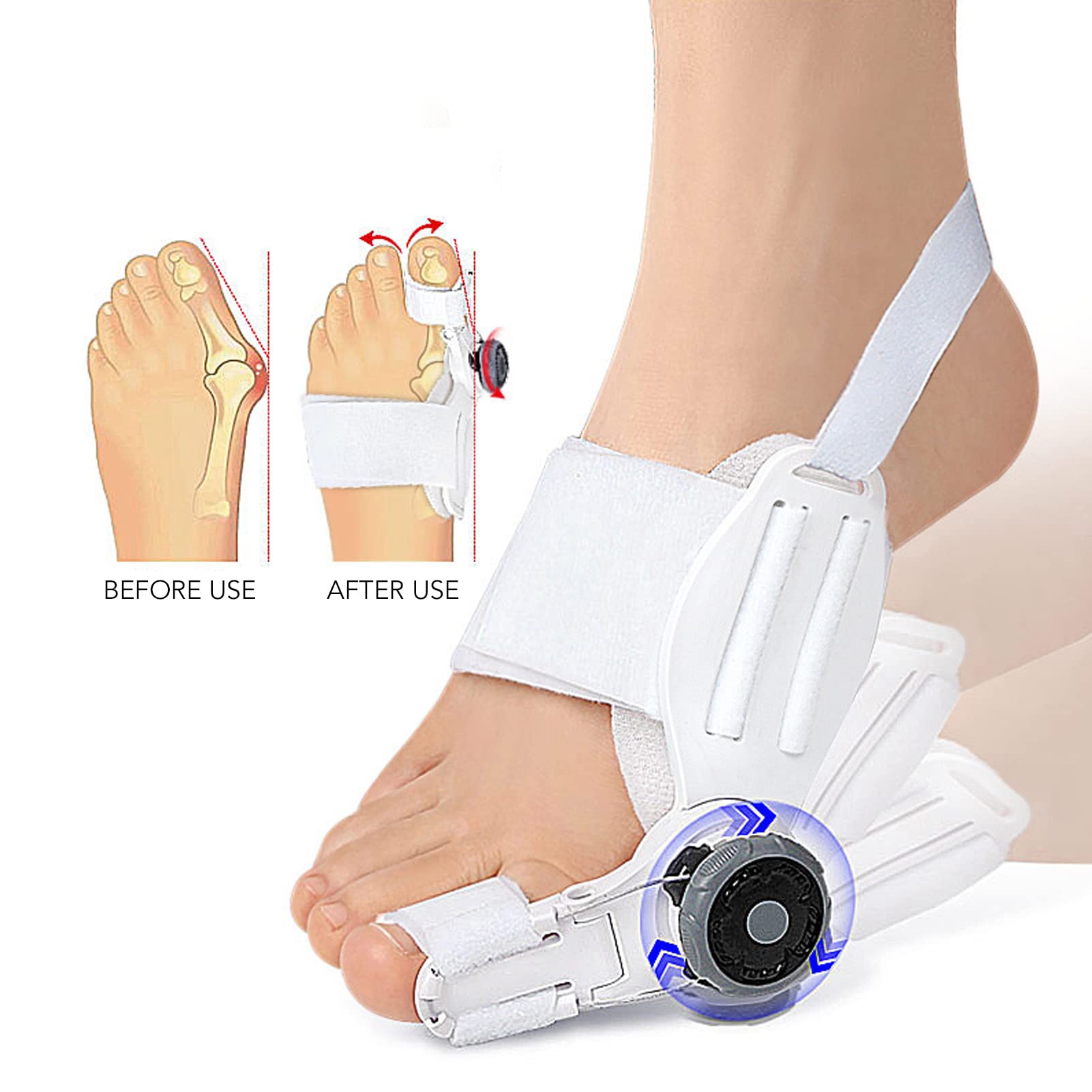Yosoo Bunion Corrector Bunion Corrector Splint, Hallux Valgus Corrector Big Toe Brace Adjust Degrees Thicken Silicone Prevent Ov