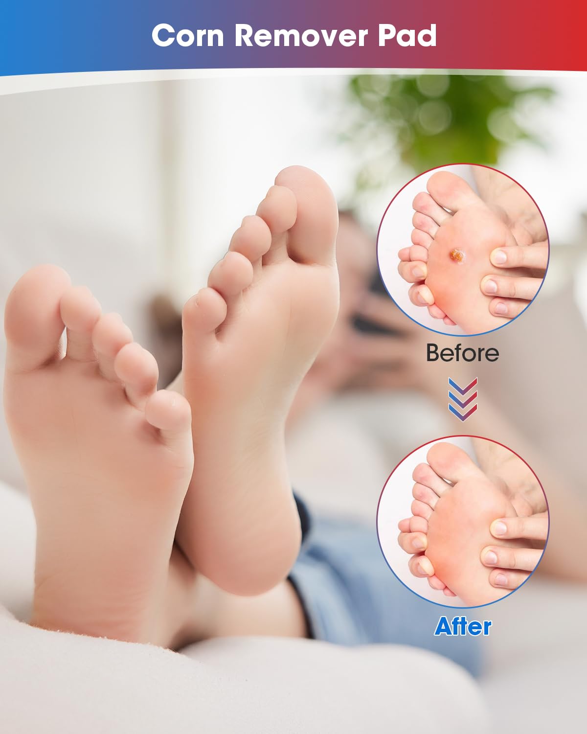 MYMULIKE Corn Removers for Feet 60 Pack, 30 Large Size and 30 Small Size Foot Corn Removers, 2 Size Corn Removers for Toe (60 Co