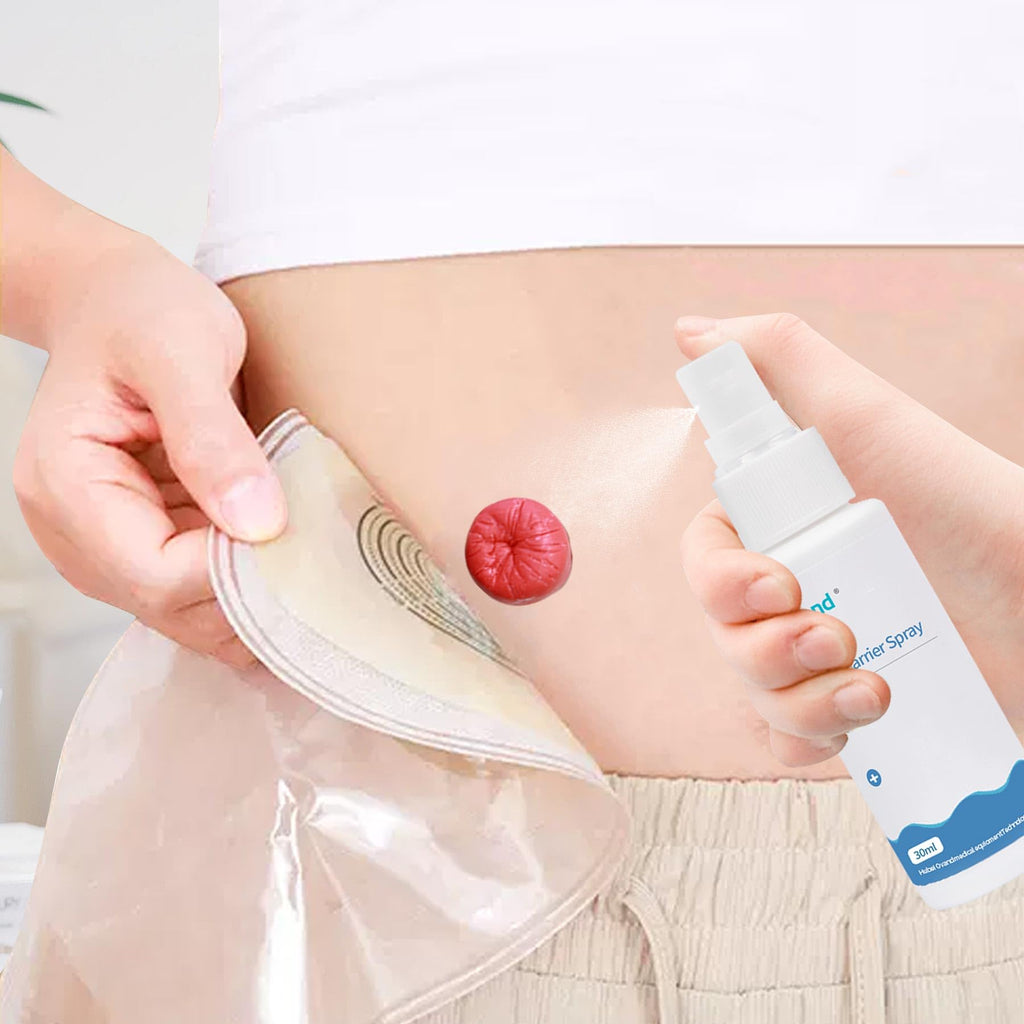 ovand 60ml Ostomy Skin Barrier Spray, No-Alcohol No-Sting Ostomy Care Skin Barrier Spray Colostomy Supplies Accessories
