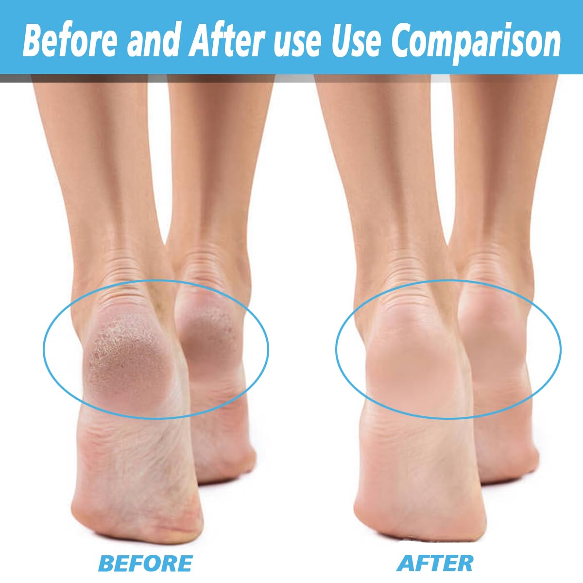 4 Pack Extra Coarse Green Replacement Roller Refills Compatible with Scholl Express Pedi Foot Smoother