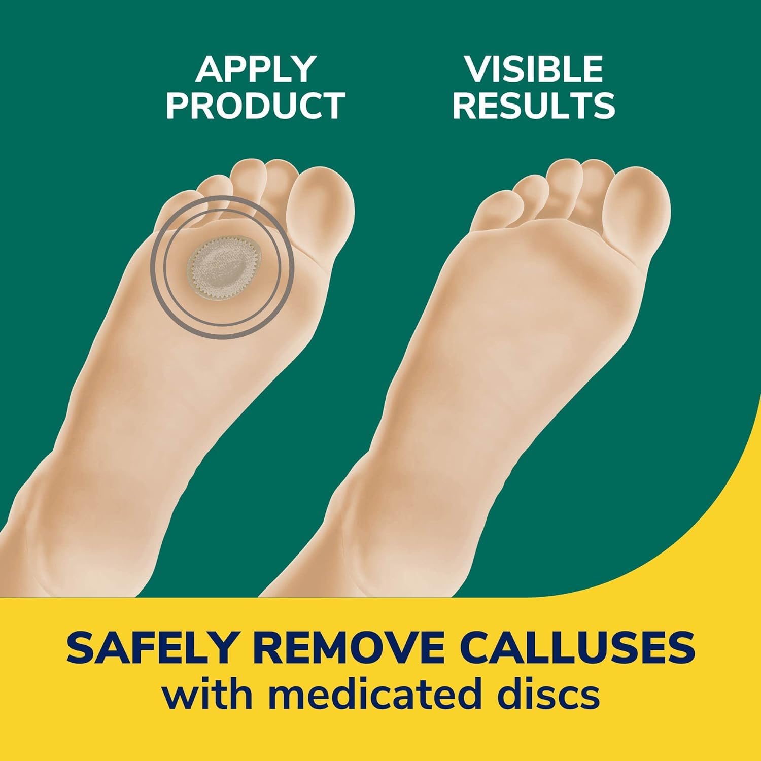 Dr. Scholl's Extra Thick Callus Removers 4 Cushions ea.(Packs of 2)
