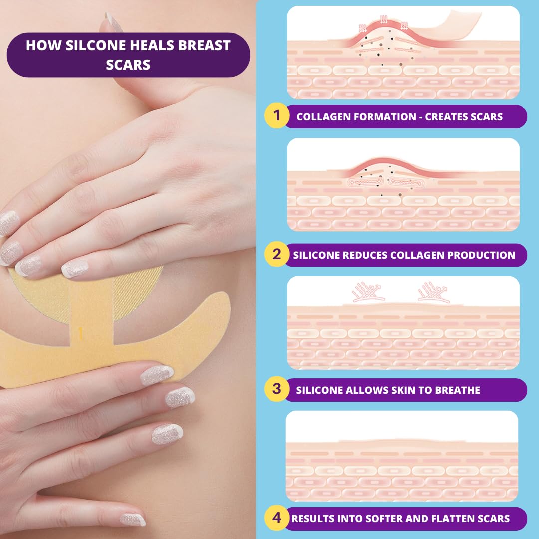 Areola Silicone Scar Sheets - Breast Surgery Recovery Supplies - Reusable and Comfortable Under Post-Op Bra (2 PCS)