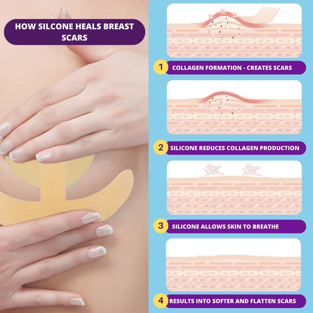 Breast Surgery Recovery Essentials - Silicone Scar Sheets for Comfort and Healing - Ideal for Post-Op Wear