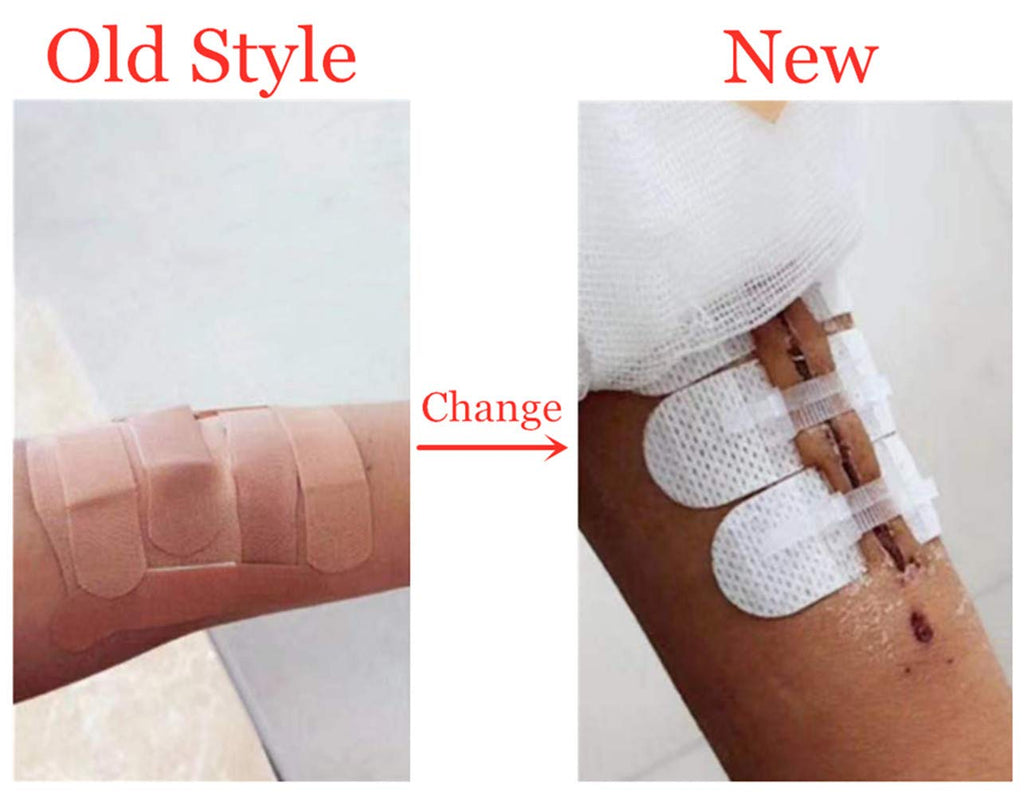 Emergency Wound Closures Adhesive Bandages, Zip Stitch Stickers for Camping, Survival & Household Gear, 3 Pcs (45 * 10mm, Skin)