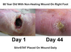 SilvrSTAT First Aid Kit Gel | 32 PPM Silver Healing Wound Dressing Solution | SilverSol Ag4O4 Particles | 3 oz