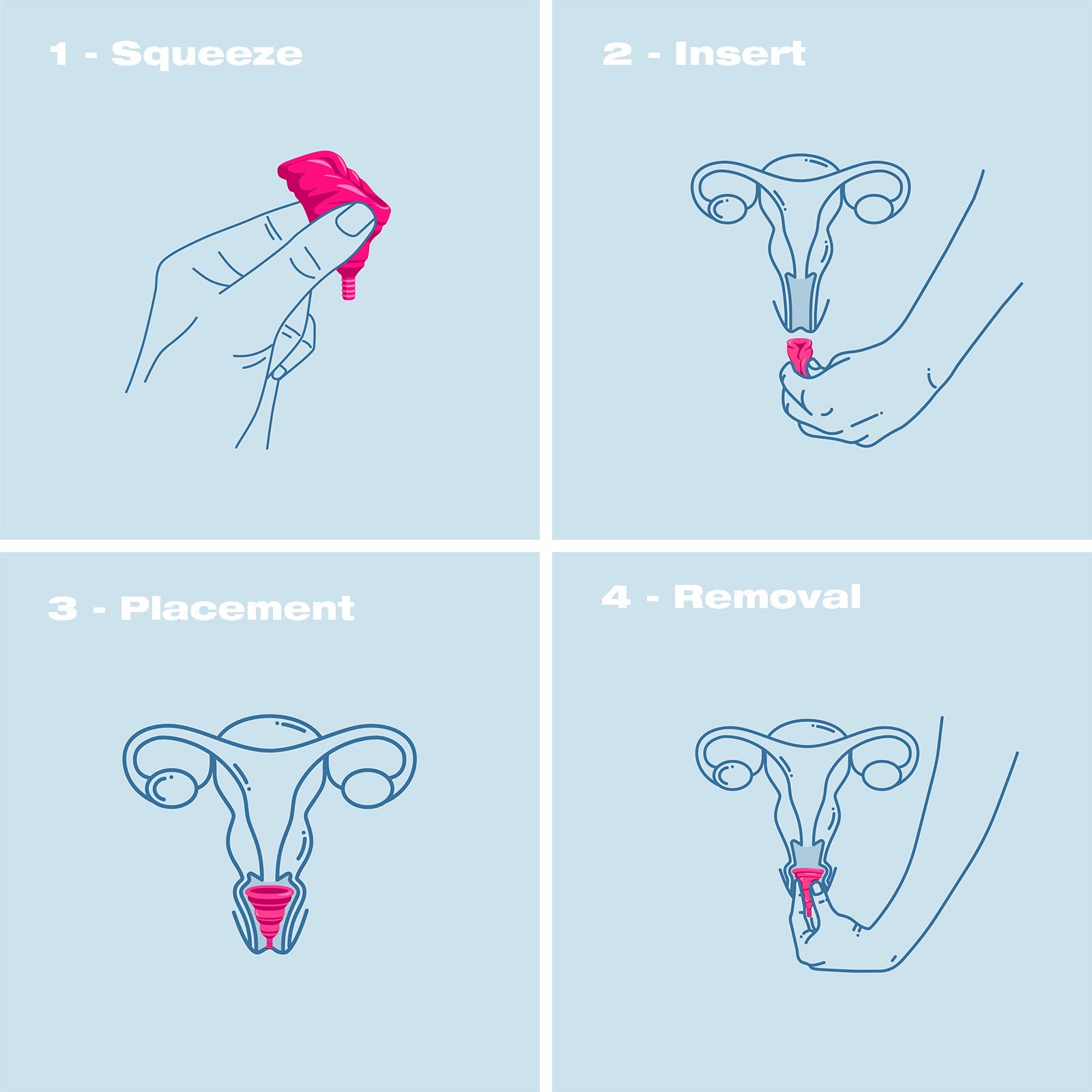 Intimina Lily Cup Compact - Small Menstrual Cup with Flat-fold Compact Design, Disposable Menstrual Cups, Period Cup Reusable (S