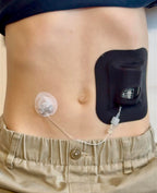 Glucomart Adhesive Pocket for Mobi (5 Count) - Maximum Strength Patches for Wearing Mobi Insulin Pump, Waterproof & Hypoallergen
