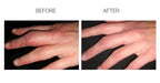 Scarfade silicone scar gel for scar removal, scar therapy - 30g Tube