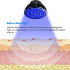 Aumtrly Blue Light Therapy Bulb, 18 LEDs Blue Light Therapy Lamp for Face and Body, High Irradiance, Large Coverage Area (Only B