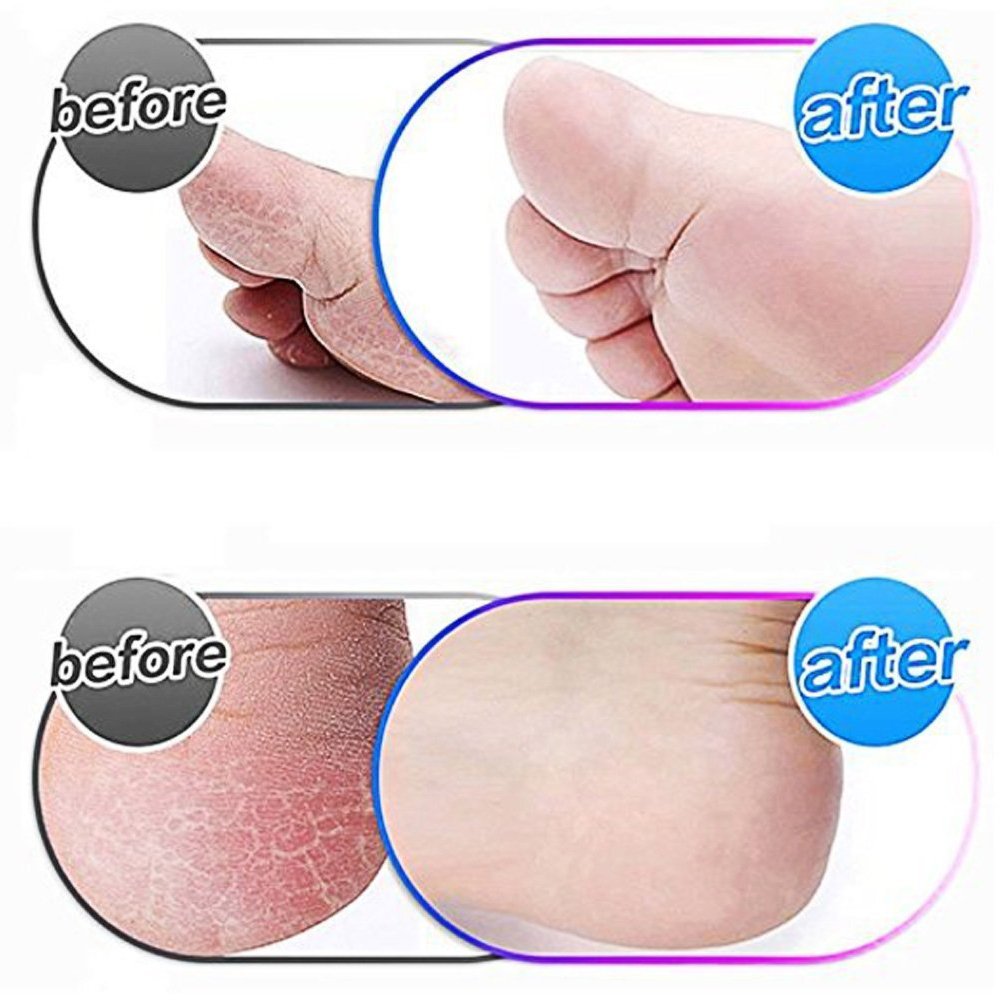 12 Pack Extra Coarse Replacement Roller for Amope Pedi,Replacement Head Refills Compatible with Amope Pedi Refills Electronic Pe