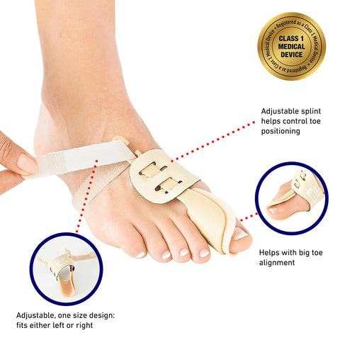 Neo-G Bunion Support - Hallux Valgus Night Splint - For Pre/Post-Operative Aid & Pressure - Class 1 Medical Device - Left - Tan