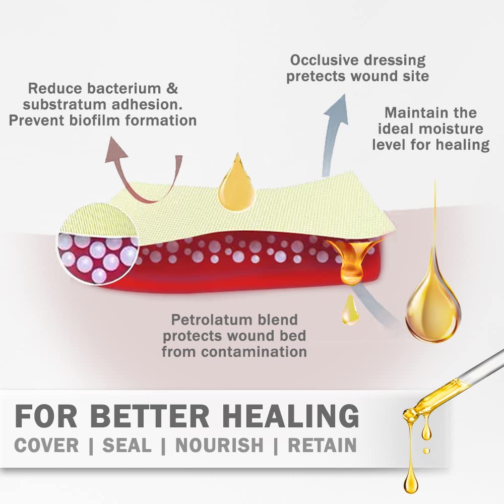 EVERLIT Xeroform Petrolatum Dressing | Sterile, Non-Adherent Occlusive Fine Mesh Gauze Pad | Non-Toxic, Gentle Patch for Burns,