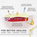 EVERLIT Xeroform Petrolatum Dressing | Sterile, Non-Adherent Occlusive Fine Mesh Gauze Pad | Non-Toxic, Gentle Patch for Burns,