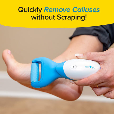PedEgg Power Cordless Motorized Callus Remover w/ Bright LED Light As Seen On TV, Quickly Removes Calluses & Dry Skin w/ 2000 RP