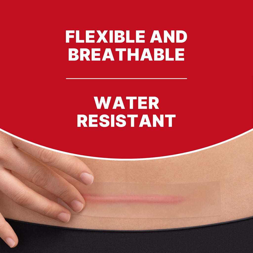 Elastoplast Scar Reducer Plasters (21 Pieces), Quick and Convenient Scar Cover Up Treatment, Scar Sheets to Reduce Visbility of