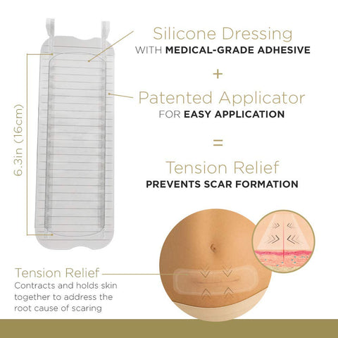 Embrace Active Scar Defense for New Scars, FDA-Cleared Silicone Scar Sheets, 6.3 Inch, X-Large, 30 Day Supply - Packaging May Va