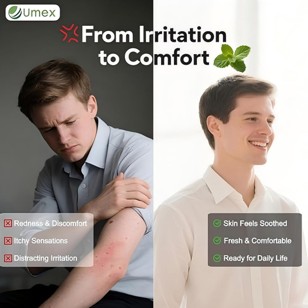 Umex Intensive Itch Relief Cream - Daily Moisturizing Lotion for Sensitive Skin, Soothes Dry & Flaky Skin, Non-Greasy & Fragranc