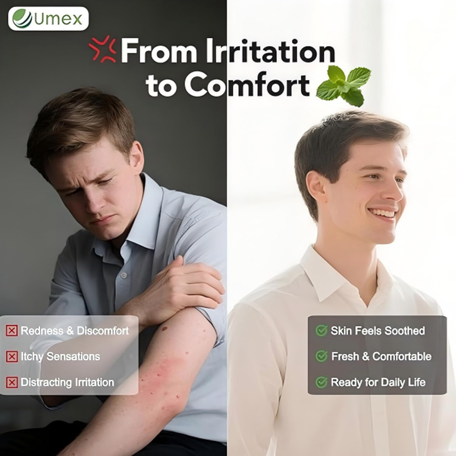 Umex Intensive Itch Relief Cream - Daily Moisturizing Lotion for Sensitive Skin, Soothes Dry & Flaky Skin, Non-Greasy & Fragranc