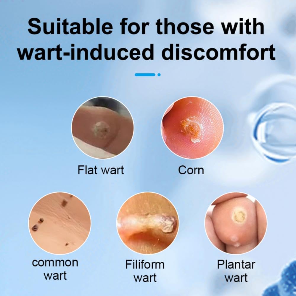 Wart Remover Liquid for Body - Skin Tag Removal Serum with Precise Applicator, Removes Plantar Warts, Gentle Natural Herbal Form