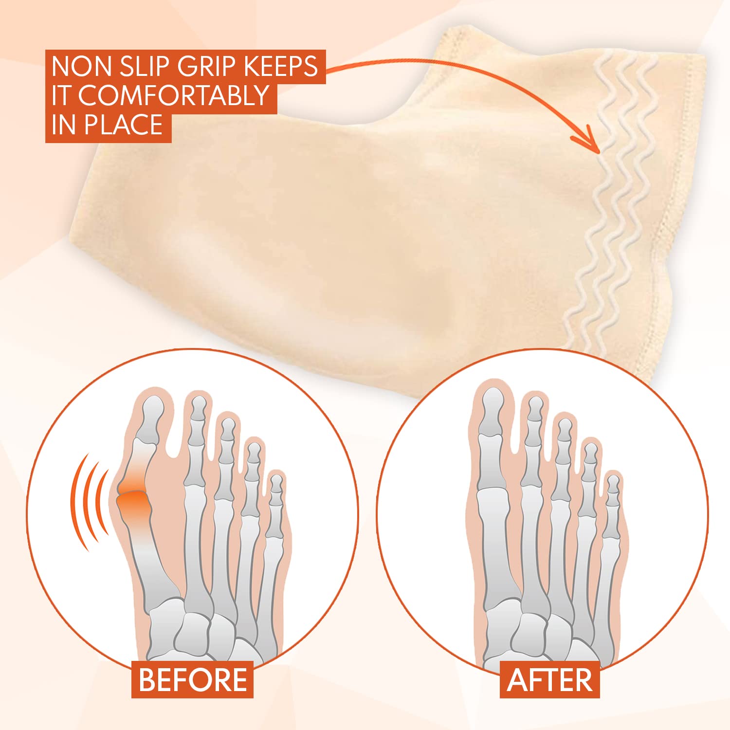 Bunion Corrector for Women & Men - Bunion Pads Relief Orthopedic Sock Cushion Sleeve Splint Gel Protector Support Brace w/ Non-S