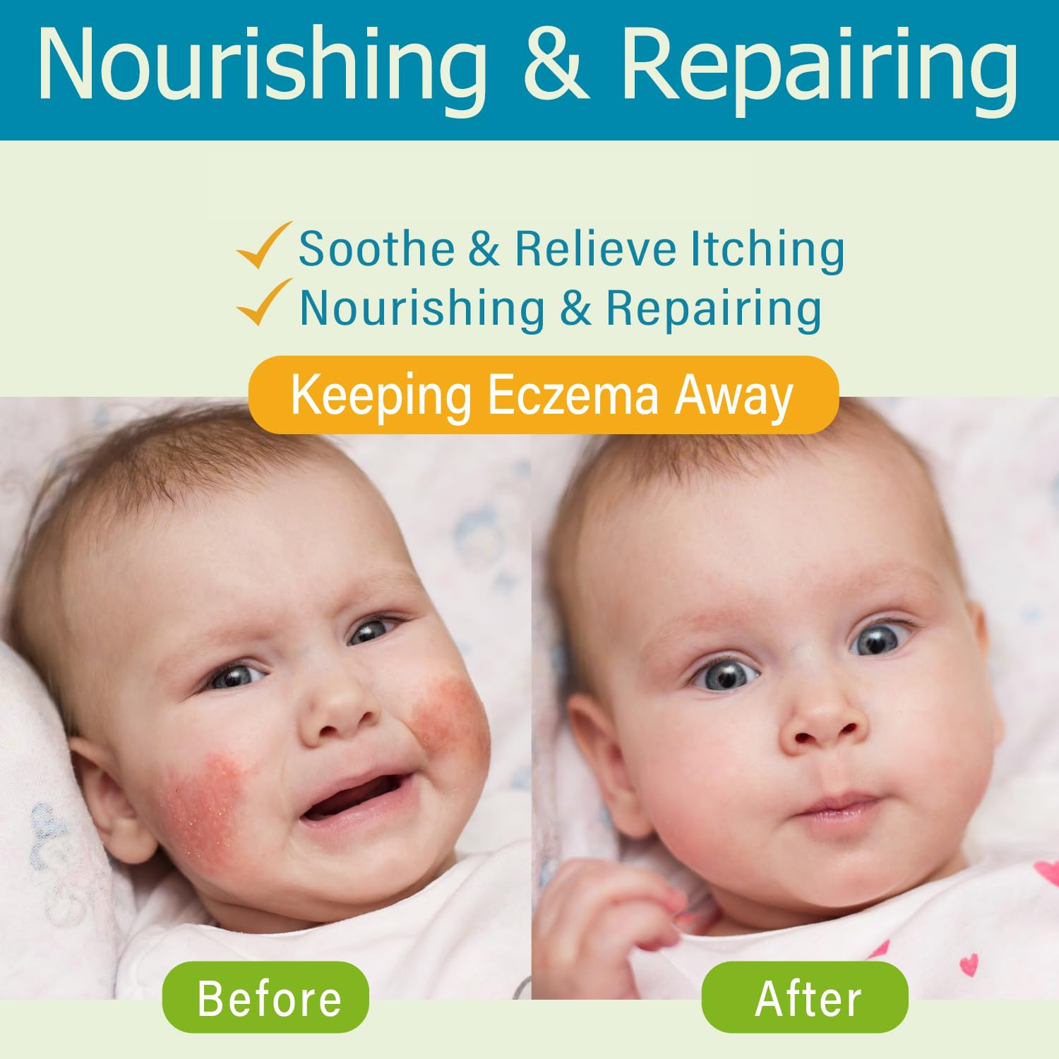Baby Eczema Cream - Kids Eczema Therapy & Relief Body Cream, Nourishing Skin Protectant Soothes & Relieves Dry, Hypoallergenic,