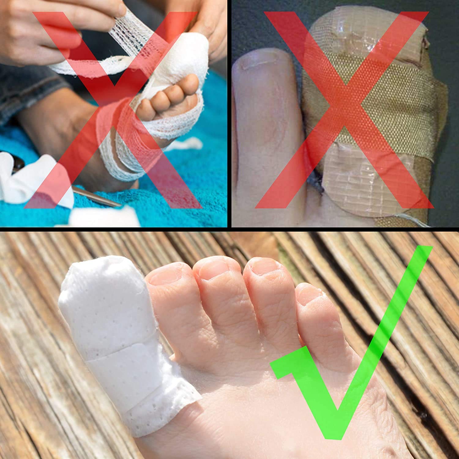 MediMitt ToeMitt Big Toe Bandages Non-Adhesive (Full Coverage Big Toe Bandage) (with Absorbent Pad, X-Large (Pack of 10))