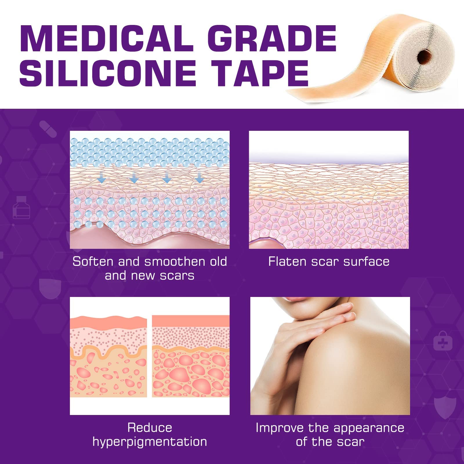 Kelinul Silicone Scar Sheets(1.6 x 120''Roll) Scar Removal Silicone Scar Tape for Softening and Flattening Scars, Acne, C-Sectio