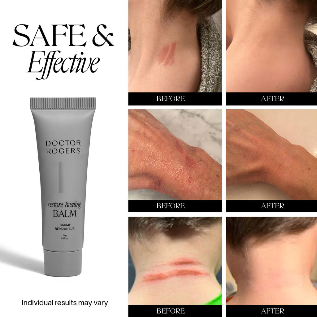 Doctor Rogers Restore Healing Balm. Multi-Purpose Healing Ointment & Moisturizing Eczema Relief Gel, Protects & Soothes Injured,
