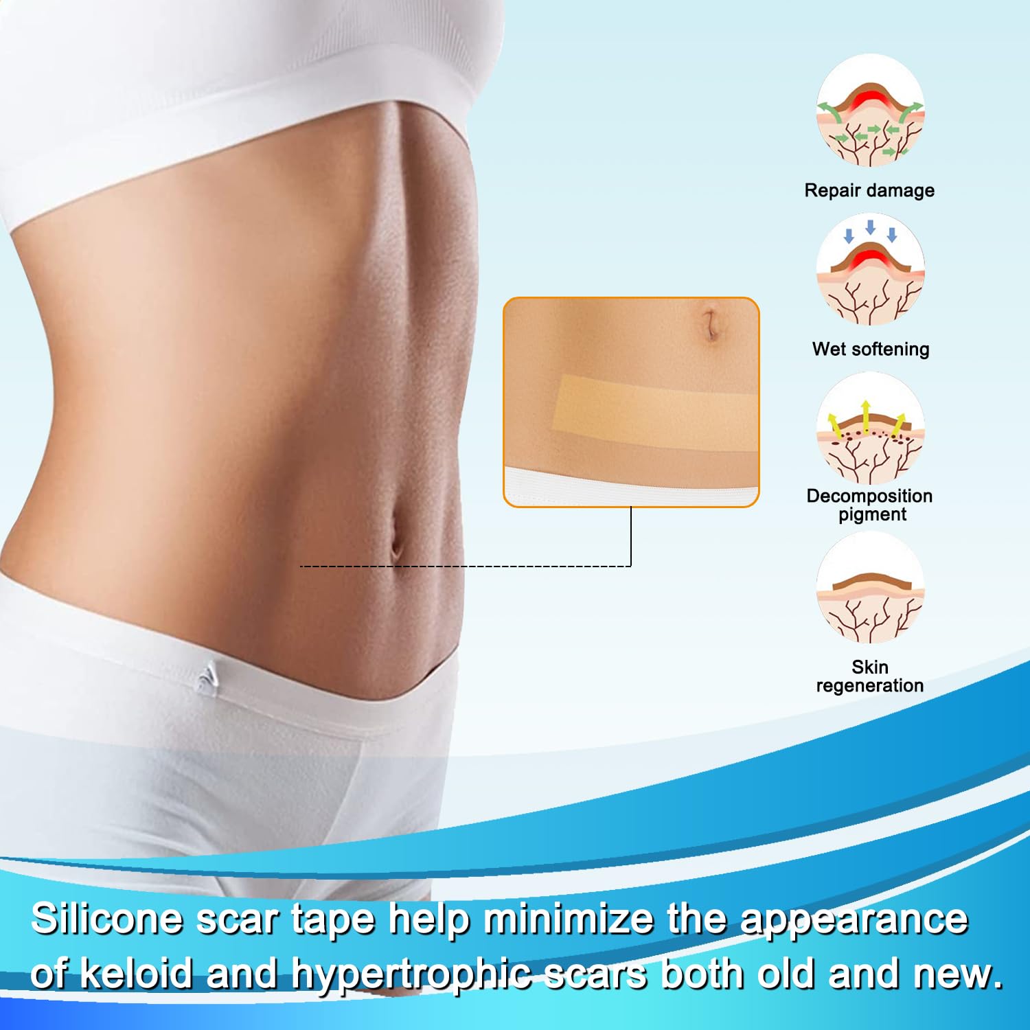 Medical Grade Silicone Scar Tape for Surgical Scars (1.6'' x 120'' - 3M) Professional Silicone Scar Sheets Scar Treatment for Fa