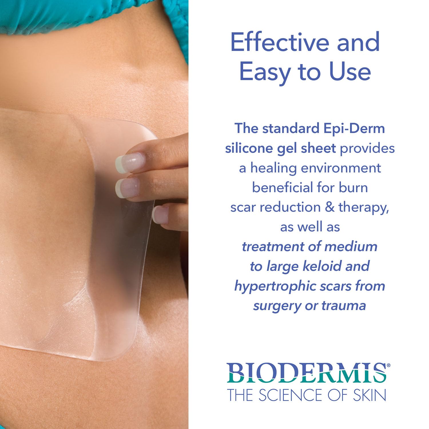 Epi-Derm Keloid Standard Premium Grade Silicone Scar Sheets for C-Section, Tummy Tuck, Cardiac Surgery Scars, Easy to Use & Reus