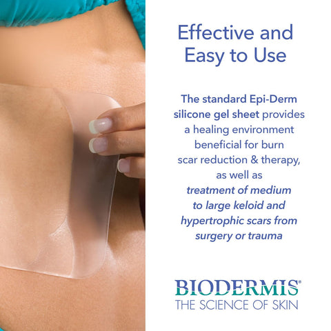 Epi-Derm Standard Premium Grade Silicone Scar Sheets for C-Section, Tummy Tuck, Hysterectomy & Cardiac Surgery Scars, Easy to Us