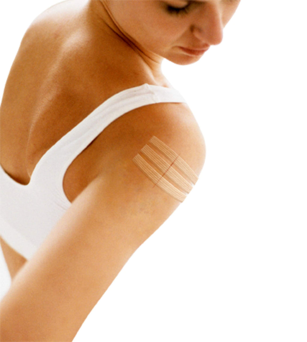 Nexcare Steri-Strip Wound Closure, Breathable Strips Hold Small Wounds Firmly Closed, Great After Sutures or Staples - 30 Wound