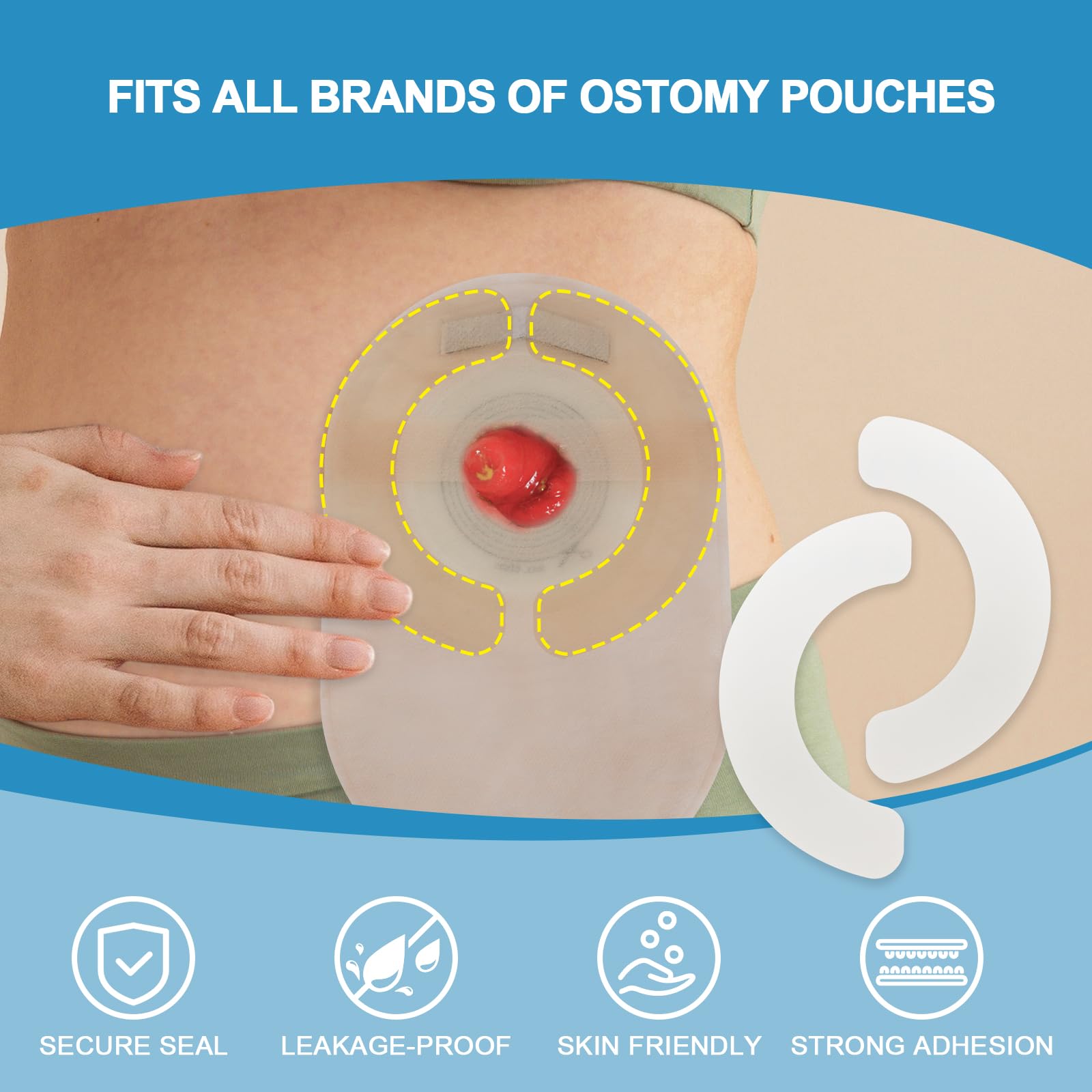 KONWEDA Ostomy Barrier Strips | Elastic Barrier Strips for Colostomy Bags [Pack of 10]