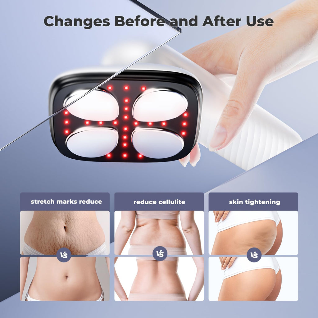 Depsoul Cellulite Massager for Women Handheld Body Massager - Cordless Massager for Belly, Arm, Waist, Leg, Butt, Back, White-4g