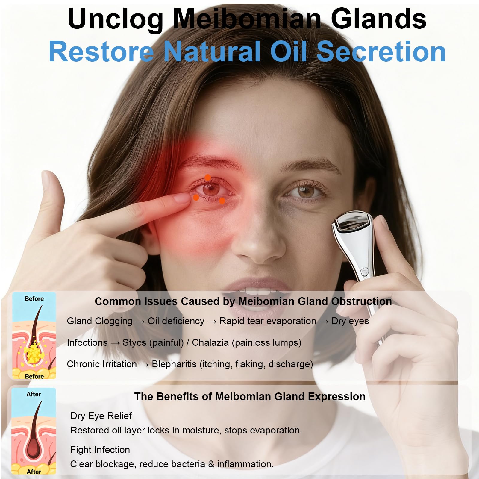 NKQ Metal Eye Roller for Dry Eyes,Eyelid Roller for Chalazion,Stye,MGD Relief,Improves Meibum Flow and Unclogs Oil Glands,Gentle