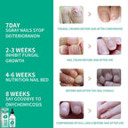 Kerassentials Nails Nutrient Oil,Kerassentials Toenail Oil,Nail Repair Solution,Nail Renewal Liquid For Damaged & Discoloration