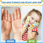 Xtinmee 20 Pairs Eczema Gloves for Kids Cotton Moisturizing Gloves for Sensitive Irritated Skin Eczema Reusable Elastic Hand Cov