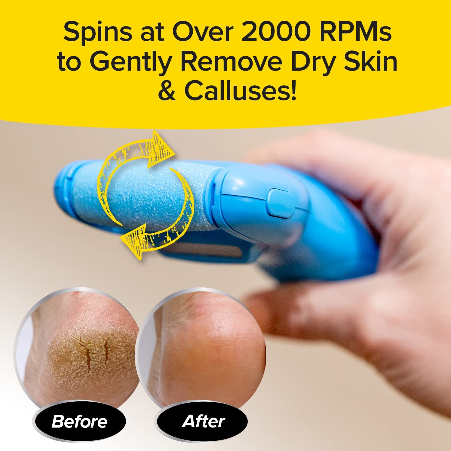 PedEgg Power Cordless Motorized Callus Remover w/ Bright LED Light As Seen On TV, Quickly Removes Calluses & Dry Skin w/ 2000 RP