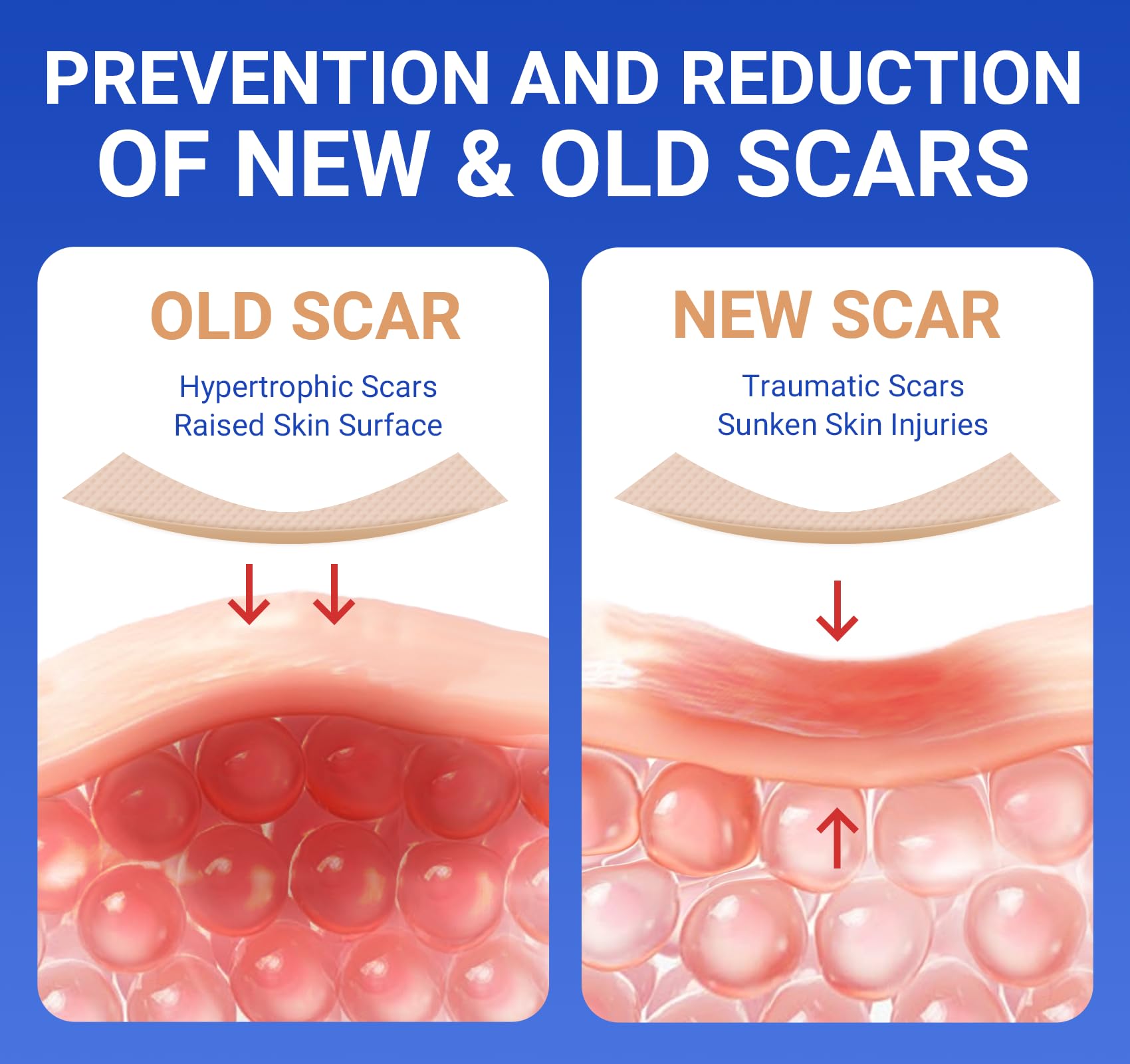 Silicone Scar Sheets Surgical Tape (1.6   x120    Roll) Face Patches Acne Treatment C Section Strips, Skin-Sensitive Medical Gra