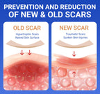 Silicone Scar Sheets Surgical Tape (1.6   x120    Roll) Face Patches Acne Treatment C Section Strips, Skin-Sensitive Medical Gra