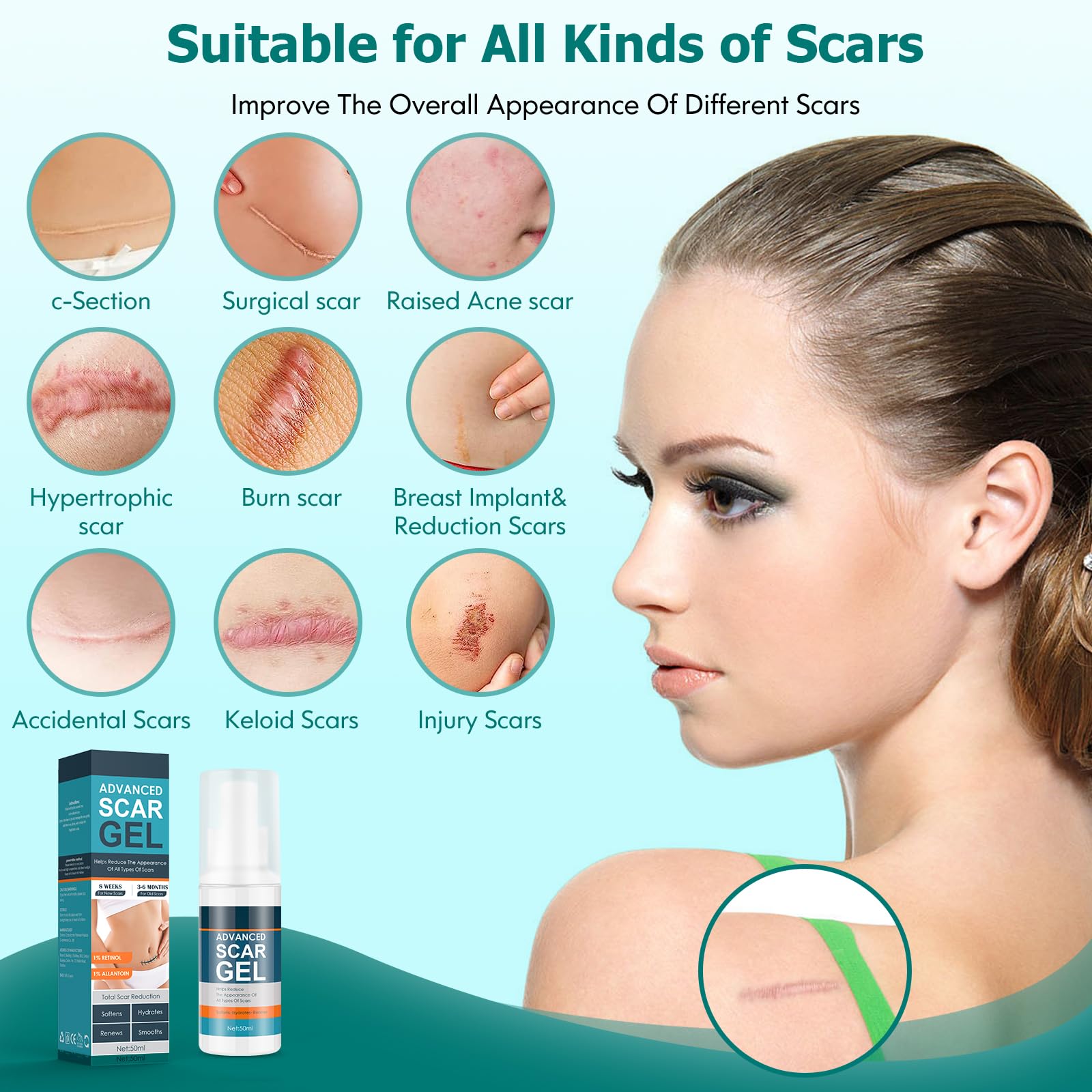 Gowgaw Scar Gel, Scar Cream, Advance Scar Gel for Surgical Scars,Face,Body,Leg, Burns, Acene,C-Section, Stretch Marks, Keloids,S