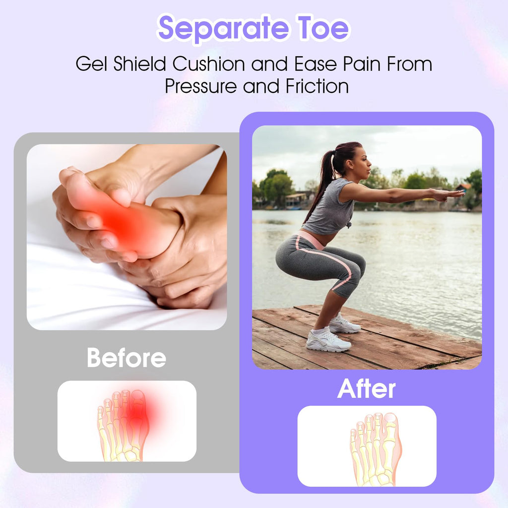 Sibba Silicone Toe Sleeves 30Pcs - Pinky Protector Gel Tubes, Corn Pads, Reusable Caps, Cushion Soft Calluses Protectors, Remove