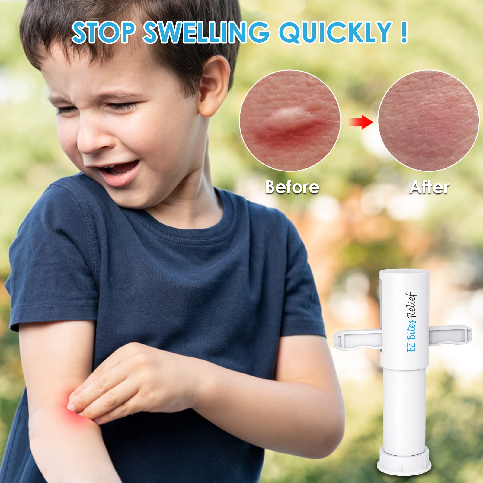 Bug Bite Suction Tool, Kid Friendly Bug Bite Sucker, Venom Extractor, Natural Reduce Itching & Swelling, Bite & Sting First Aid