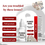 Toenail Fungus Treatment, Herbal Extracts, Nighttime Long-Lasting Nail Treatment, Suitable for Discoloration, Shaped Nails, Thic