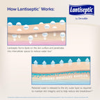 DermaRites Lantiseptic Dry Skin Therapy Skin Protectant - Scented Moisturizing Cream, Enriched with 30% Lanolin - 4 oz. Tube, 1