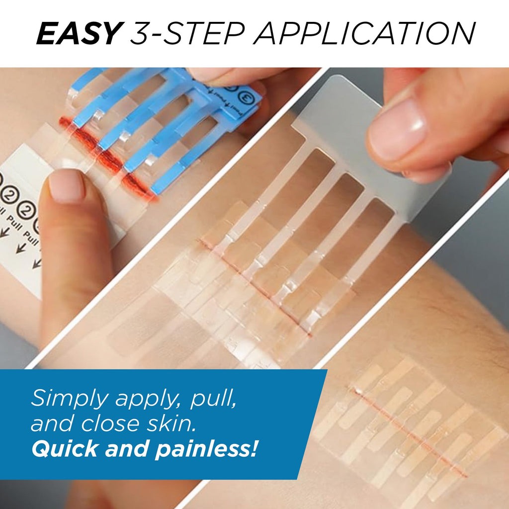 Clozex Emergency Laceration Kit - Repair Wounds Without Stitches, Skin Closure Device for a Wound Up to 1 1/2 Inches Length. Com